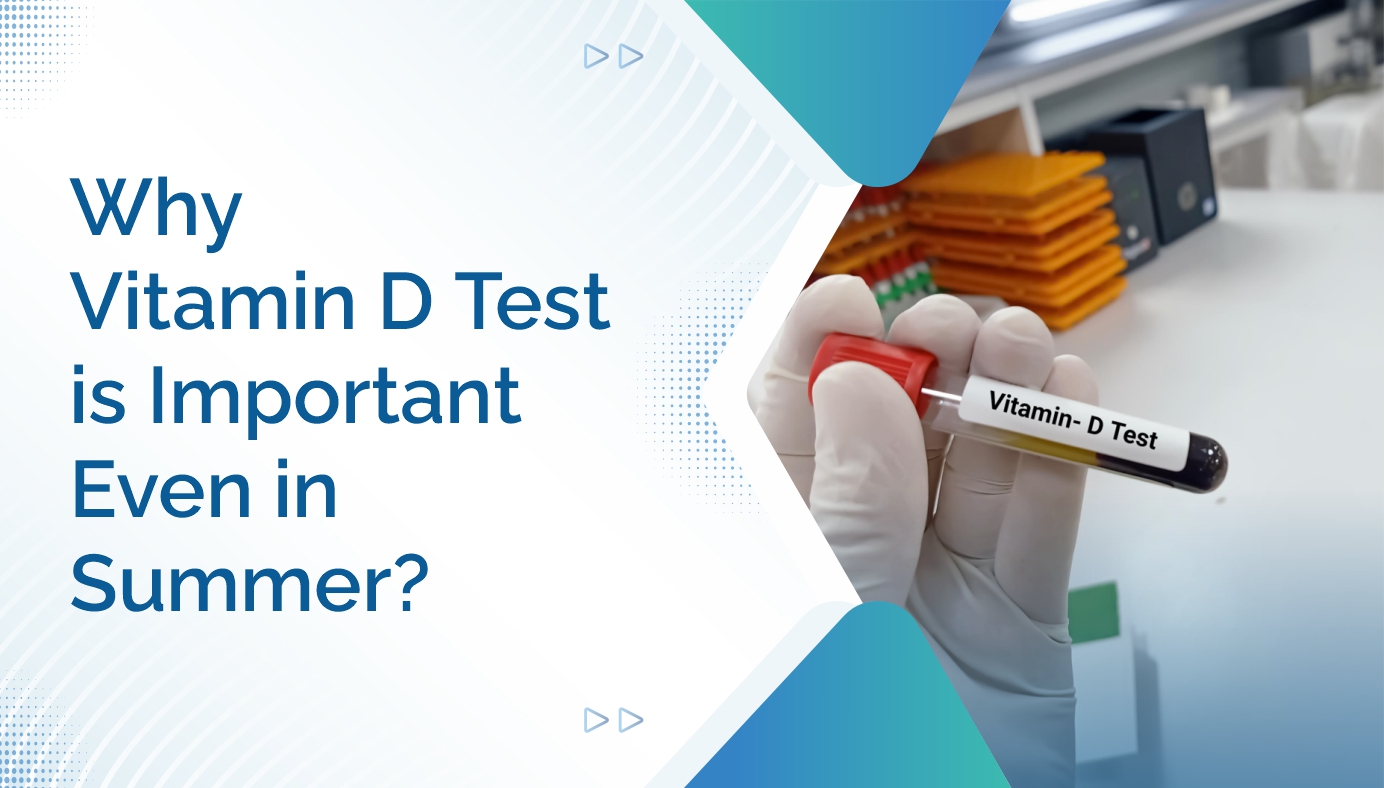 https://ampath.com/category/923_19. Why Vitamin D Test Is Important Even in Summer.jpg